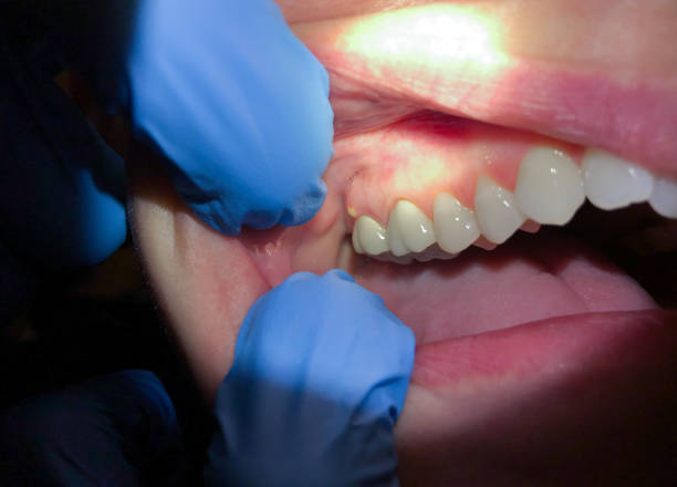Best Urgent Dental Care  in Stacy, MN